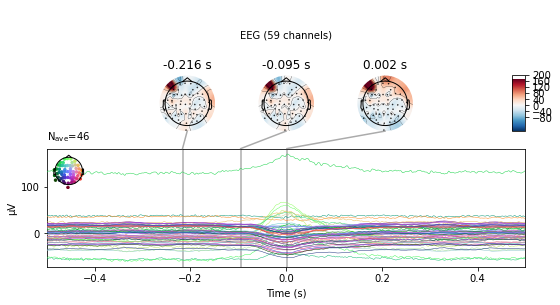 ../_images/mne_preprocessing_28_1.png