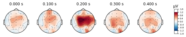 ../_images/mne_workflow_tutorial_117_0.png